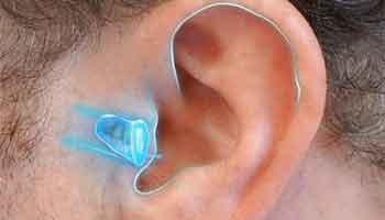 Solución auditiva CIC oído izquierdo tecnología audífono - Audioactive