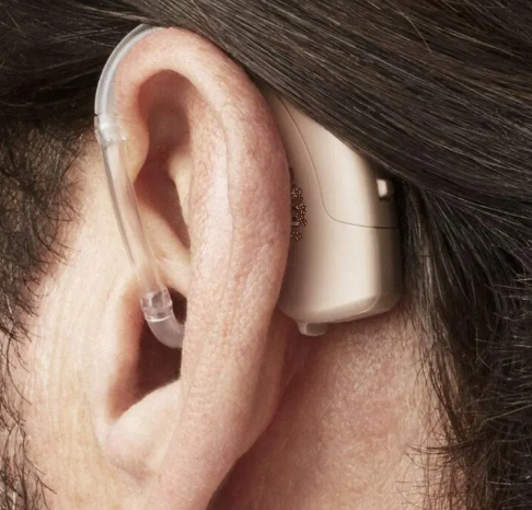 Solución auditiva super Power tecnología de audífono
